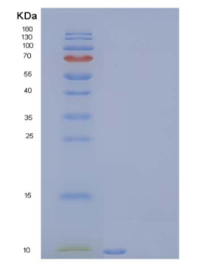 Recombinant Human Insulin-Like Growth Factor II/IGF2 Protein,Recombinant Human Insulin-Like Growth Factor II/IGF2 Protein