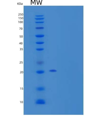 Recombinant Human Fibroblast Growth Factor 21/FGF-21 Protein(N-6His),Recombinant Human Fibroblast Growth Factor 21/FGF-21 Protein(N-6His)