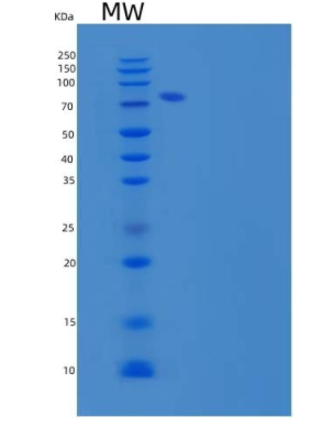 Recombinant Human Semaphorin 3C/SEMA3C Protein(C-6His),Recombinant Human Semaphorin 3C/SEMA3C Protein(C-6His)