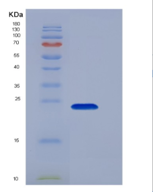 Recombinant Human CD16a / FCGR3A Protein (176 Val, His tag),Recombinant Human CD16a / FCGR3A Protein (176 Val, His tag)