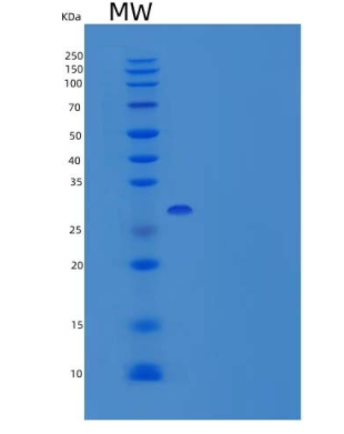 Recombinant Human MMP-3 Protein,Recombinant Human MMP-3 Protein