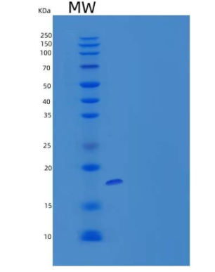 Recombinant Human CALML3 Protein (His tag),Recombinant Human CALML3 Protein (His tag)