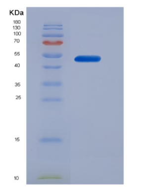 Recombinant Human CD16b / FCGR3B Protein,Recombinant Human CD16b / FCGR3B Protein