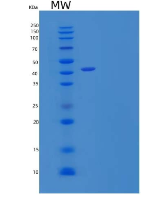 Recombinant Human CD99 Antigen-Like Protein 2/CD99L2 Protein(C-Fc),Recombinant Human CD99 Antigen-Like Protein 2/CD99L2 Protein(C-Fc)