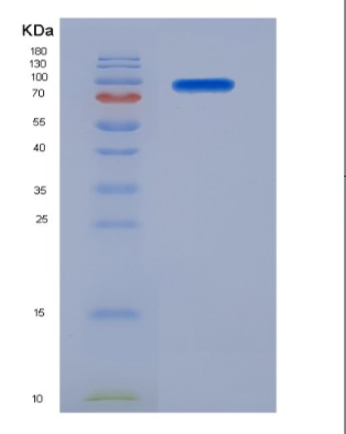 Eukaryotic Cluster Of Differentiation 56 (CD56),Eukaryotic Cluster Of Differentiation 56 (CD56)