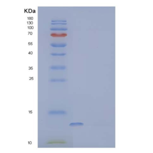 Recombinant Human Secreted and Transmembrane Protein 1 Protein