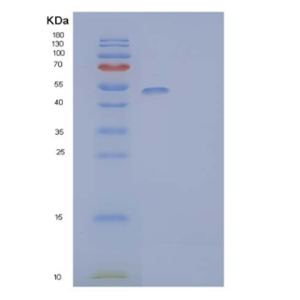Recombinant Mouse Natural Cytotoxicity Triggering Receptor 1/NCR1Protein (C-6His)
