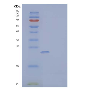 Recombinant Mouse NKG2D Ligand 1/NKG2DL/ULBP1 Protein(C-6His)