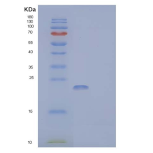 Recombinant Mouse SLAM Family Member 7 Protein