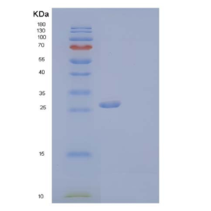 Recombinant Human Collectin-11/COLEC11 Protein(C-6His),Recombinant Human Collectin-11/COLEC11 Protein(C-6His)