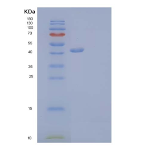 Recombinant Mouse GITR/TNFRSF18/CD357 Protein(C-Fc-6His)