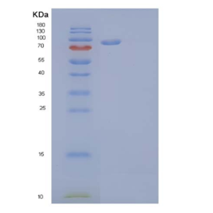 Recombinant Human Oncostatin-M-Specific Receptor Subunit β/OSMRB/IL-31RB Protein(C-6His),Recombinant Human Oncostatin-M-Specific Receptor Subunit β/OSMRB/IL-31RB Protein(C-6His)