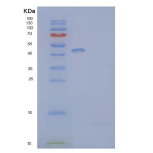 Recombinant Human T-lymphocyte Surface Antigen Ly-9/SLAMF3/CD229 Protein(C-6His)