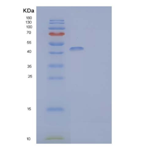 Recombinant Mouse HLADG/CD74 Protein(C-mFc-6His)