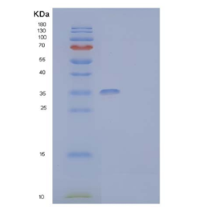 Recombinant Human Granulocyte-Macrophage Colony-Stimulating Factor Receptor Subunit alhpa Protein