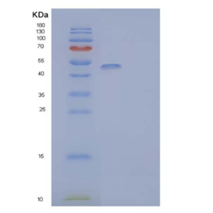 Recombinant Human Lymphocyte Activation Gene 3 Protein Protein