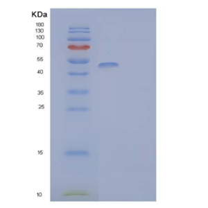 Recombinant Human Lymphocyte Activation Gene 3 Protein Protein,Recombinant Human Lymphocyte Activation Gene 3 Protein Protein