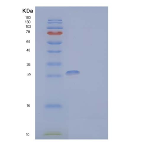 Recombinant Human IL-2 Receptor Subunit γ/IL-2RG/CD132 Protein(C-Fc-6His)