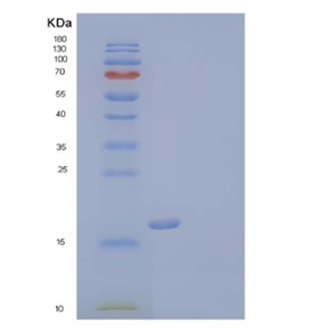 Recombinant Human Triggering Receptor Expressed On Myeloid 2/TREM-2 Protein(C-6His)