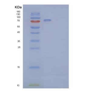 Recombinant Human Ephrin type-B receptor 2 Protein