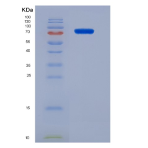 Eukaryotic Vascular Endothelial Growth Factor Receptor 2 (VEGFR2)