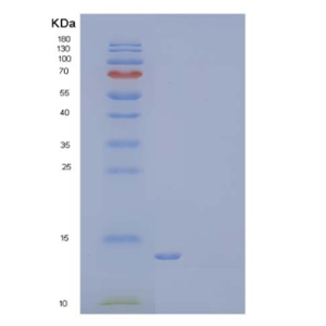 Recombinant Mouse LAIR1 Protein(C-6His),Recombinant Mouse LAIR1 Protein(C-6His)