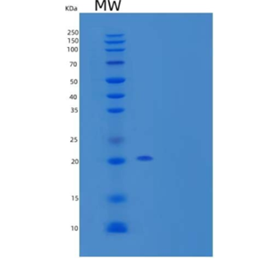 Recombinant Human Fibroblast Growth Factor 21/FGF-21 Protein(N-6His)