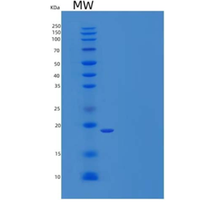 Recombinant Human UBE2W Protein (His tag)