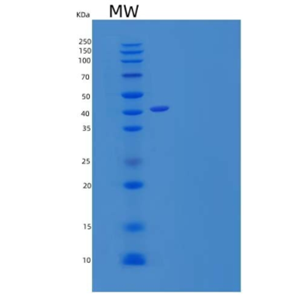 Recombinant Human CD83/HB15 Protein(C-Fc)