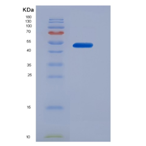 Recombinant Human CD16b / FCGR3B Protein