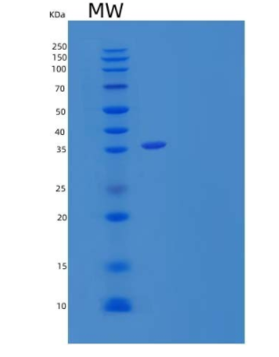 Recombinant Human Sulfotransferase 1A2/SULT1A2 Protein(N-6His),Recombinant Human Sulfotransferase 1A2/SULT1A2 Protein(N-6His)