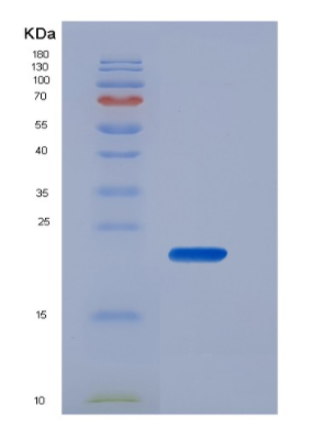 Recombinant Human CD16b / FCGR3B Protein (His tag),Recombinant Human CD16b / FCGR3B Protein (His tag)