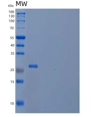 Recombinant Human Thiamin Pyrophosphokinase 1/TPK1 Protein(C-6His),Recombinant Human Thiamin Pyrophosphokinase 1/TPK1 Protein(C-6His)