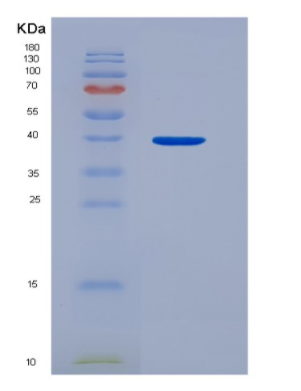 Recombinant Hepatoma Derived Growth Factor (HDGF),Recombinant Hepatoma Derived Growth Factor (HDGF)
