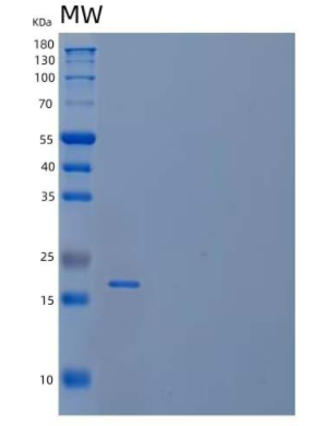 Recombinant Human Nucleolar Protein Family A Member 2/NHP2/NOLA2 Protein(N-6His),Recombinant Human Nucleolar Protein Family A Member 2/NHP2/NOLA2 Protein(N-6His)