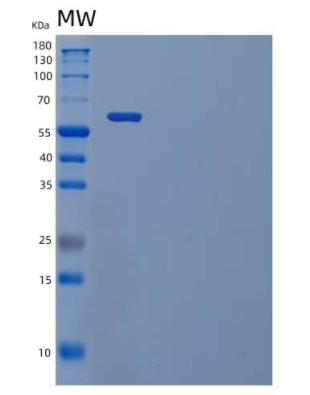 Recombinant Human IL-1 Receptor Type 1/IL-1R-1 Protein(C-Fc),Recombinant Human IL-1 Receptor Type 1/IL-1R-1 Protein(C-Fc)