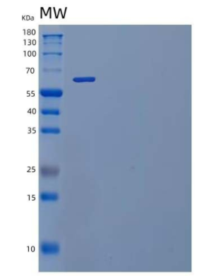 Recombinant Mouse IL-1 Receptor Type 2/IL-1R-2 Protein(C-Fc),Recombinant Mouse IL-1 Receptor Type 2/IL-1R-2 Protein(C-Fc)