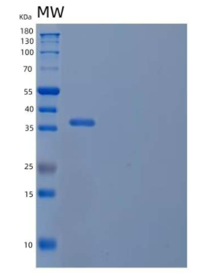 Recombinant Mouse CD5 antigen-like Protein,Recombinant Mouse CD5 antigen-like Protein