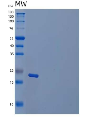 Recombinant Human Transcobalamin II Receptor/TCblR/8D6A/CD320 Protein(C-6His),Recombinant Human Transcobalamin II Receptor/TCblR/8D6A/CD320 Protein(C-6His)