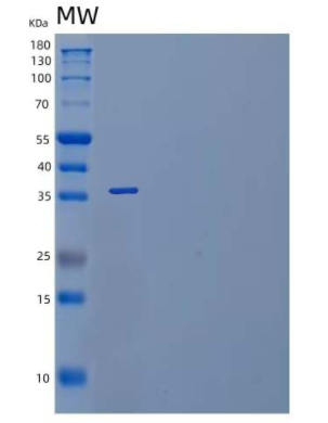 Recombinant Mouse IL-1 Receptor-Like 1/IL-1RL1/IL-1 R4 Protein(C-6His),Recombinant Mouse IL-1 Receptor-Like 1/IL-1RL1/IL-1 R4 Protein(C-6His)