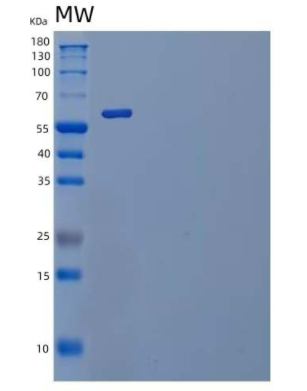 Recombinant Mouse IL-1 Receptor-Like 1/IL-1RL1/IL-1 R4 Protein(C-Fc),Recombinant Mouse IL-1 Receptor-Like 1/IL-1RL1/IL-1 R4 Protein(C-Fc)