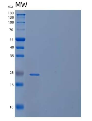 Recombinant Human Coiled-Coil Domain-Containing Protein 134/CCDC134 Protein(C-6His),Recombinant Human Coiled-Coil Domain-Containing Protein 134/CCDC134 Protein(C-6His)