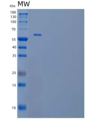 Recombinant Human Complement Factor H-related 5/CFHR5 Protein(C-6His),Recombinant Human Complement Factor H-related 5/CFHR5 Protein(C-6His)