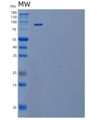 Recombinant Mouse IL-12 Receptor Subunit β2/IL-12RB2 Protein(C-Fc),Recombinant Mouse IL-12 Receptor Subunit β2/IL-12RB2 Protein(C-Fc)