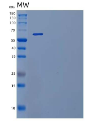 Recombinant Mouse IL-23 Receptor/IL-23R Protein(C-Fc),Recombinant Mouse IL-23 Receptor/IL-23R Protein(C-Fc)