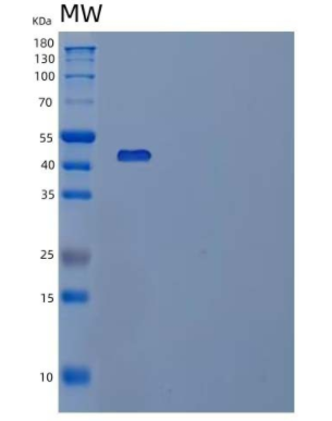 Recombinant Human PDCD1/PD-1/CD279 Protein(C-mFc),Recombinant Human PDCD1/PD-1/CD279 Protein(C-mFc)