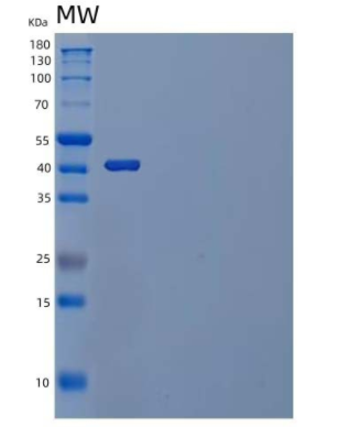 Recombinant Human TREML1/TLT-1 Protein(C-Fc),Recombinant Human TREML1/TLT-1 Protein(C-Fc)