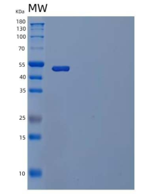 Recombinant Human TREML2/TLT-2 Protein(C-Fc),Recombinant Human TREML2/TLT-2 Protein(C-Fc)