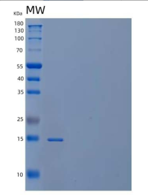 Recombinant Human PDCD5/TFAR19 Protein(N-6His),Recombinant Human PDCD5/TFAR19 Protein(N-6His)