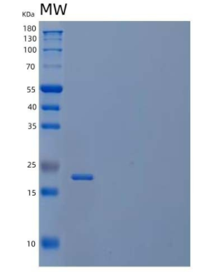 Recombinant Human Butyrophilin subfamily 3 member A3 Protein,Recombinant Human Butyrophilin subfamily 3 member A3 Protein